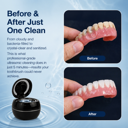 CLINORA DENTURE DOME